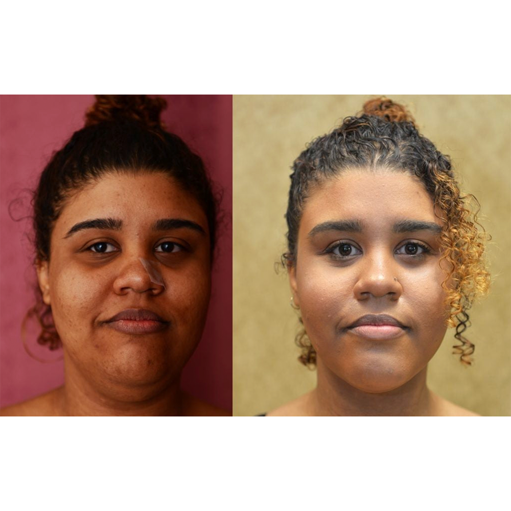 MelaDream™ Overnight Toning & Firming Cream