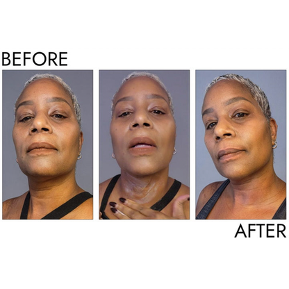 MelaDream™ Overnight Toning & Firming Cream